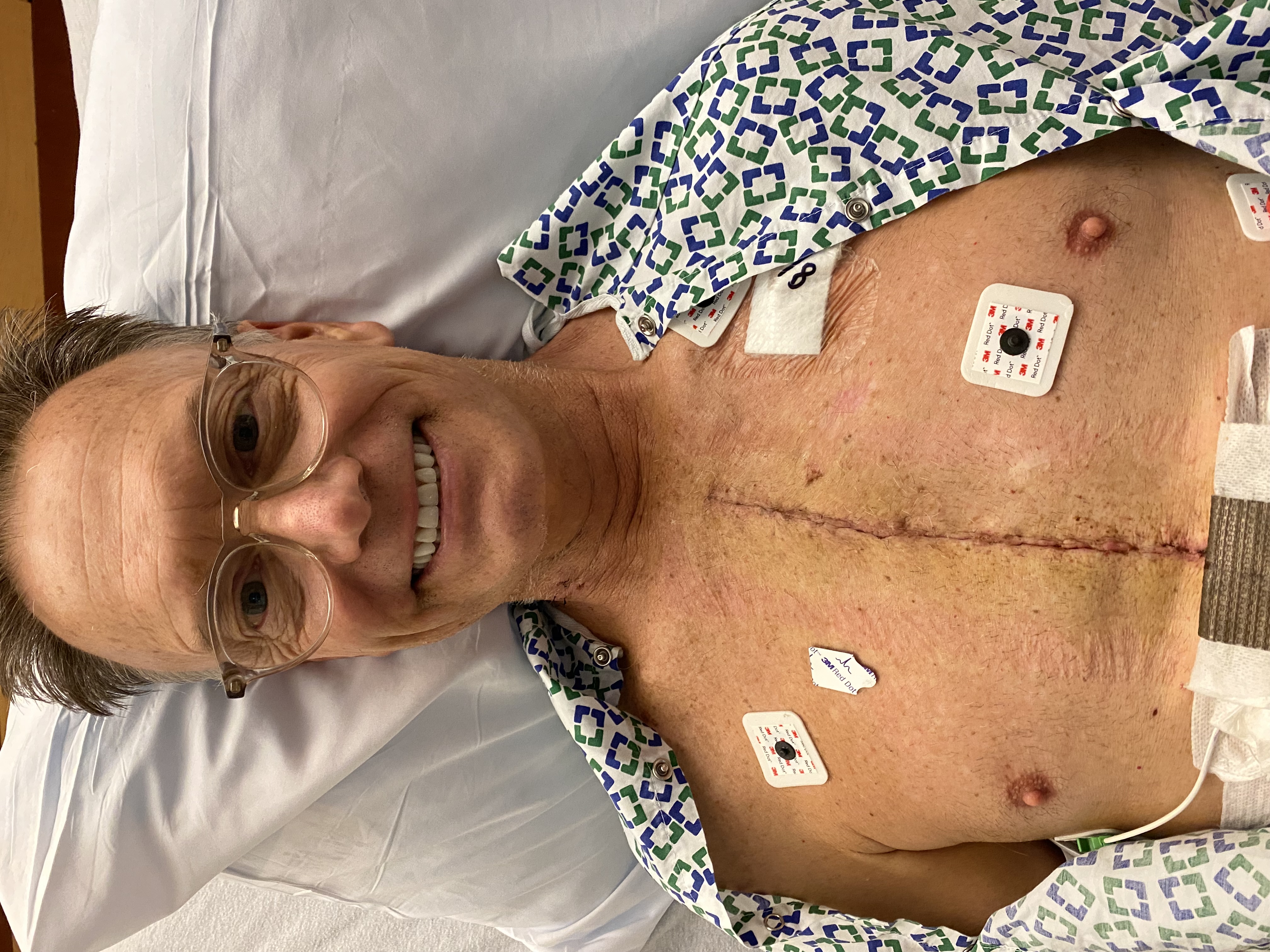 Steven Bradley post heart transplant.