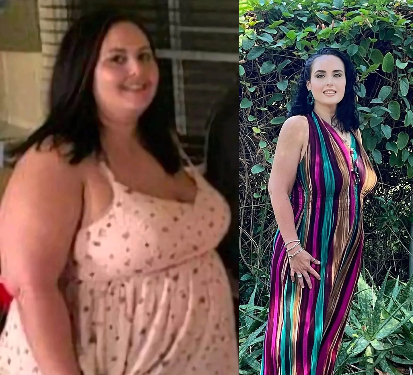 Jessey Bowers is pictured before and after weight loss surgery.