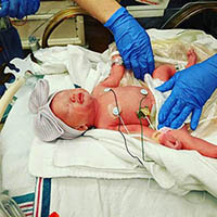 A newborn baby in a nurses hands.