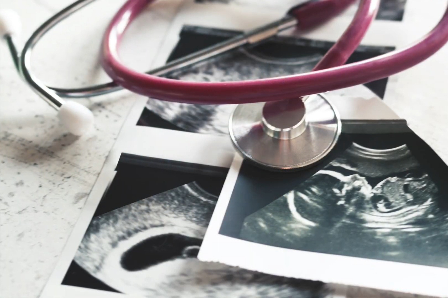 A stethoscope lays on top of several ultrasound photos of a fetus. 